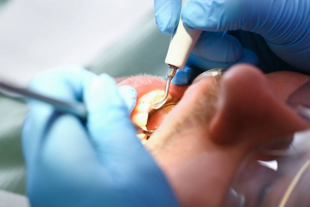 Best Emergency Treatment for Dental Infections or Abscesses in Stanaford, WV