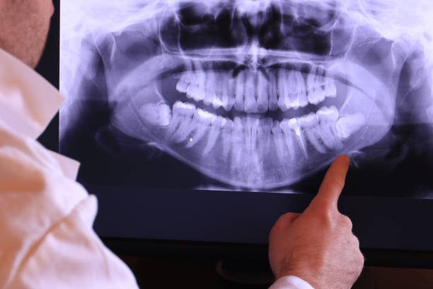 Best Emergency TMJ Treatment in Stanaford, WV