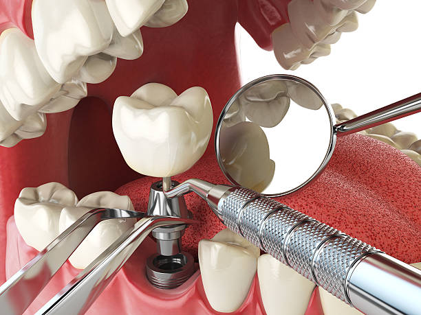 Best Urgent Care for Lost Fillings or Crowns in Stanaford, WV